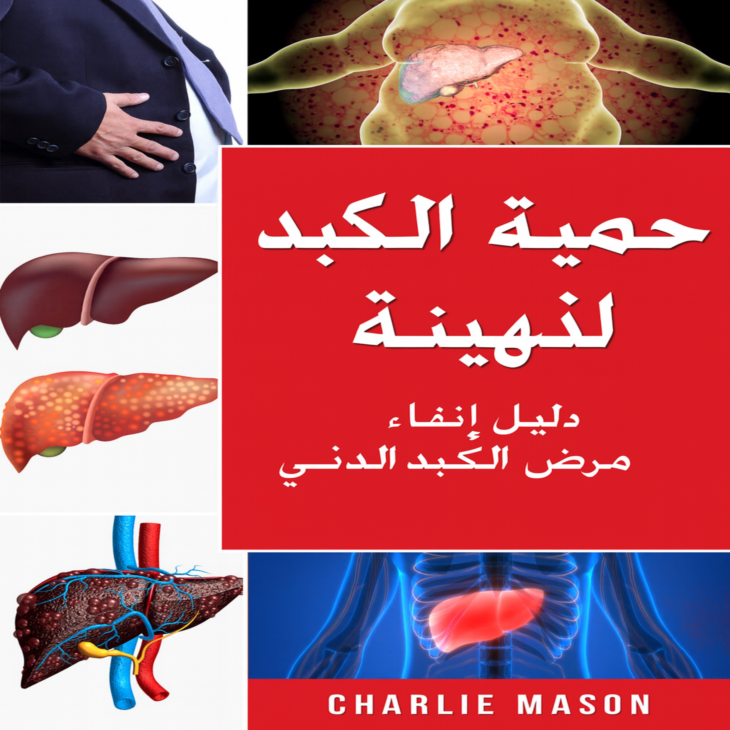نظام غذائي لعلاج الكبد الدهني. دليل حول كيفية التخلص من أمراض الكبد