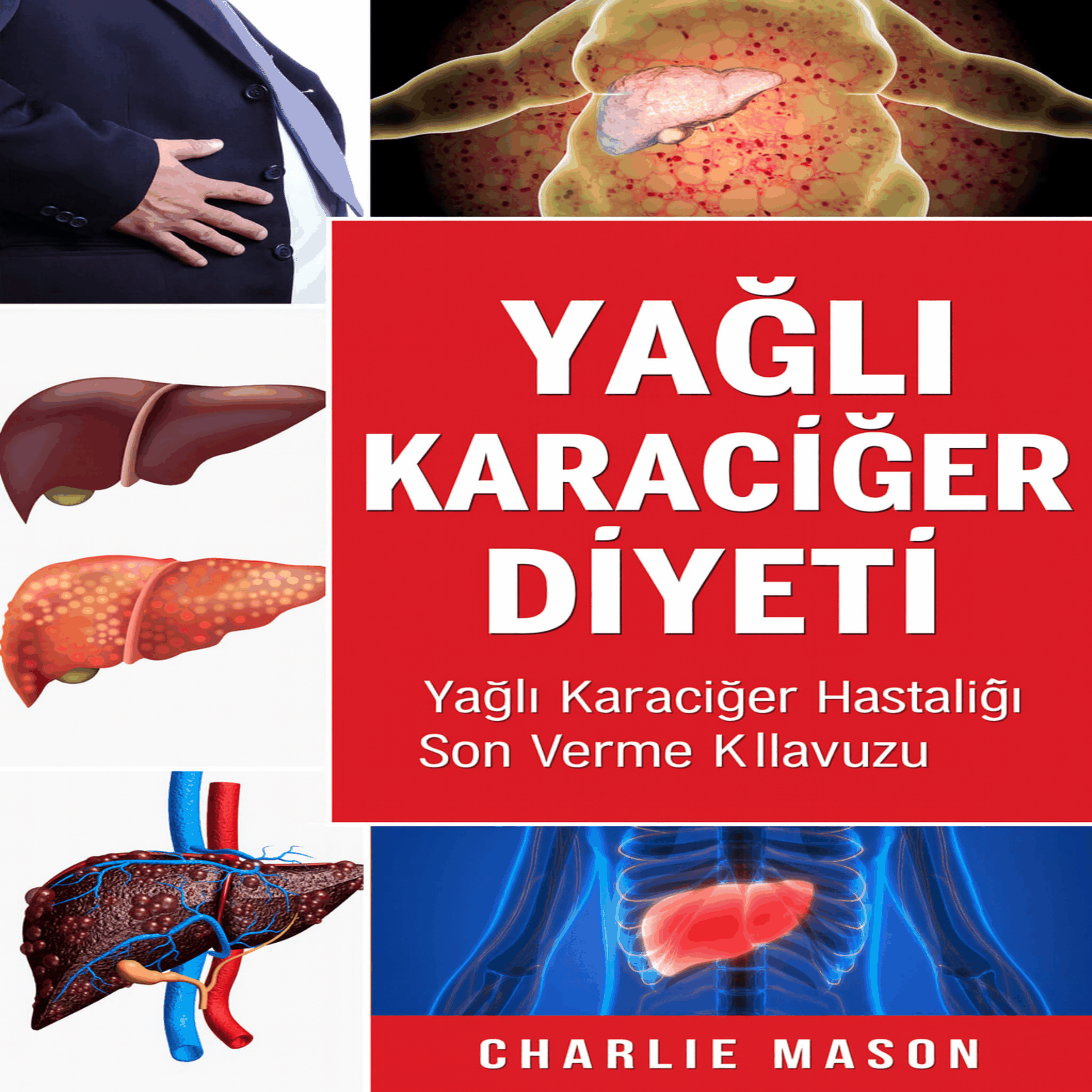 Yağlı Karaciğer Diyeti. Karaciğer Hastalığına Son Verme Rehberi