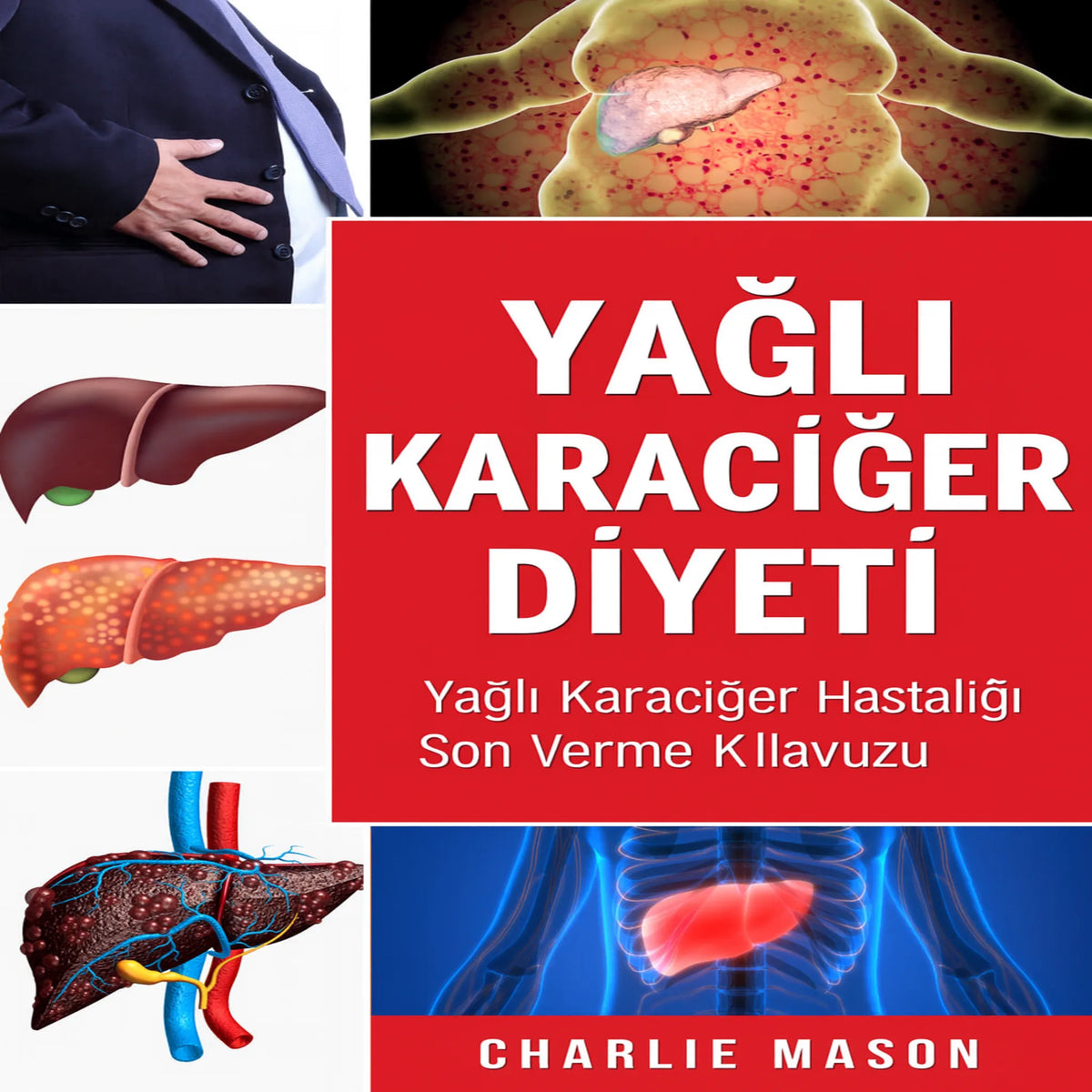 Yağlı Karaciğer Diyeti. Karaciğer Hastalığına Son Verme Rehberi