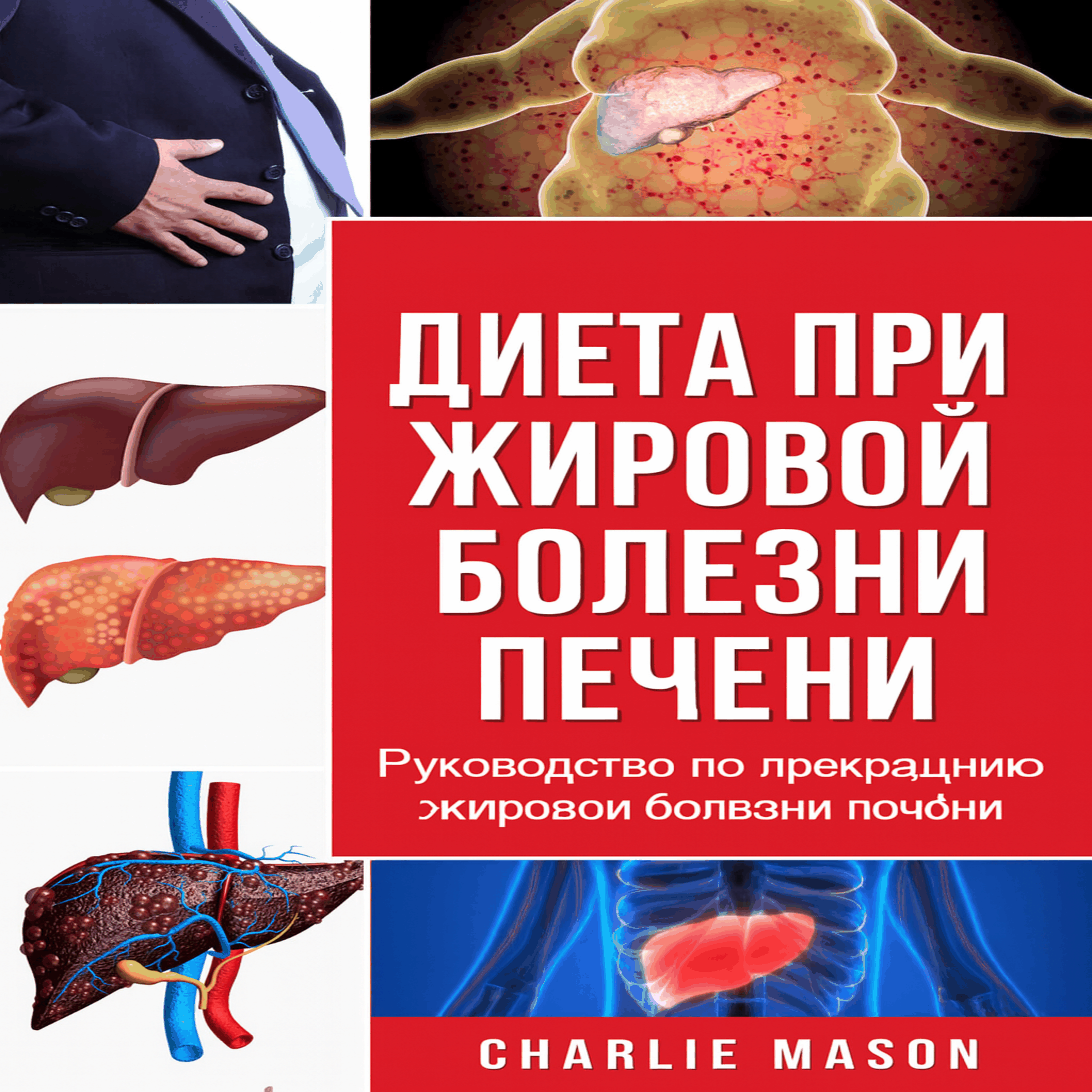 Диета при жировой дистрофии печени. Руководство по лечению заболеваний печени.