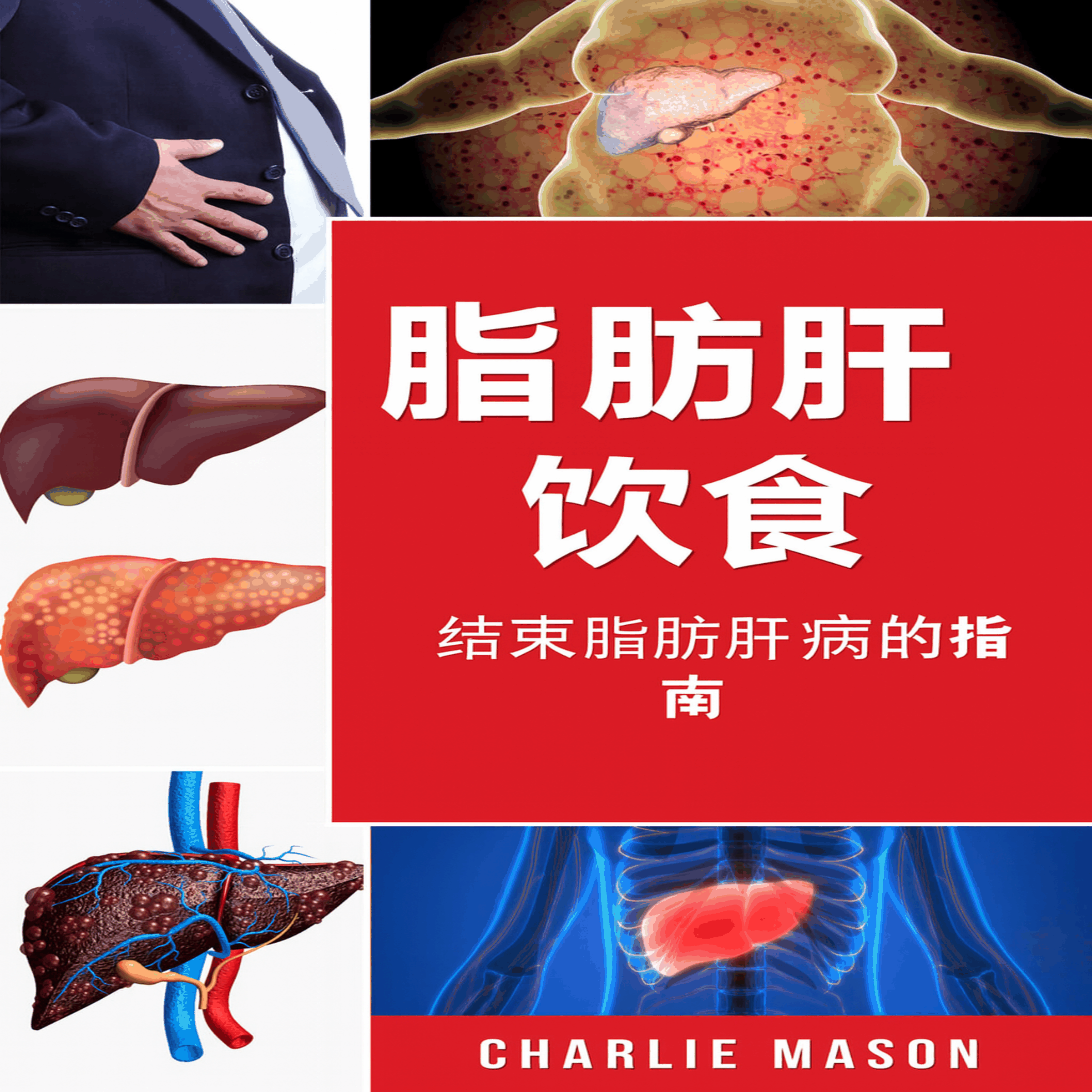 脂肪肝饮食指南:如何终结肝病
