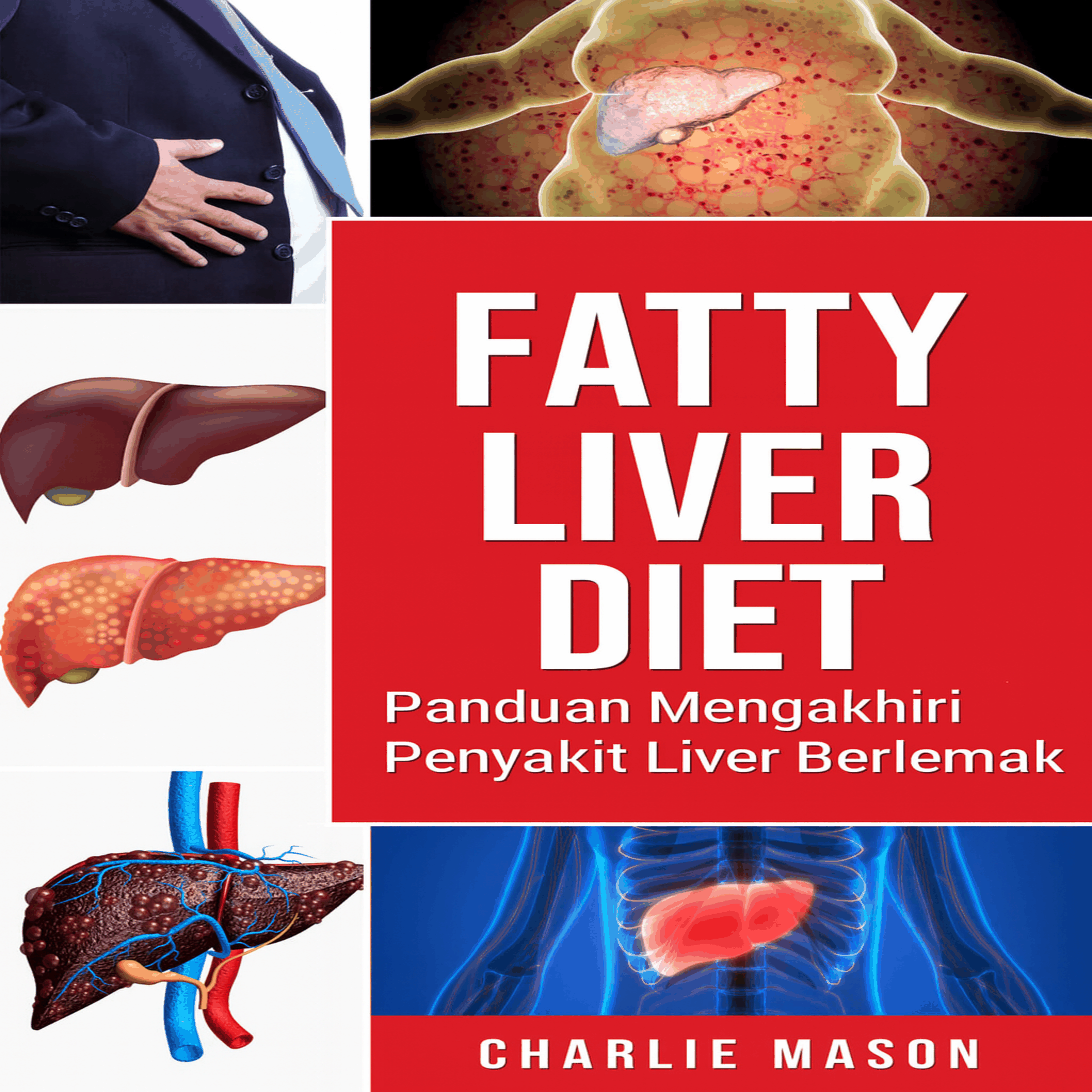 Diet untuk Hati Berlemak. Panduan Cara Mengakhiri Penyakit Hati