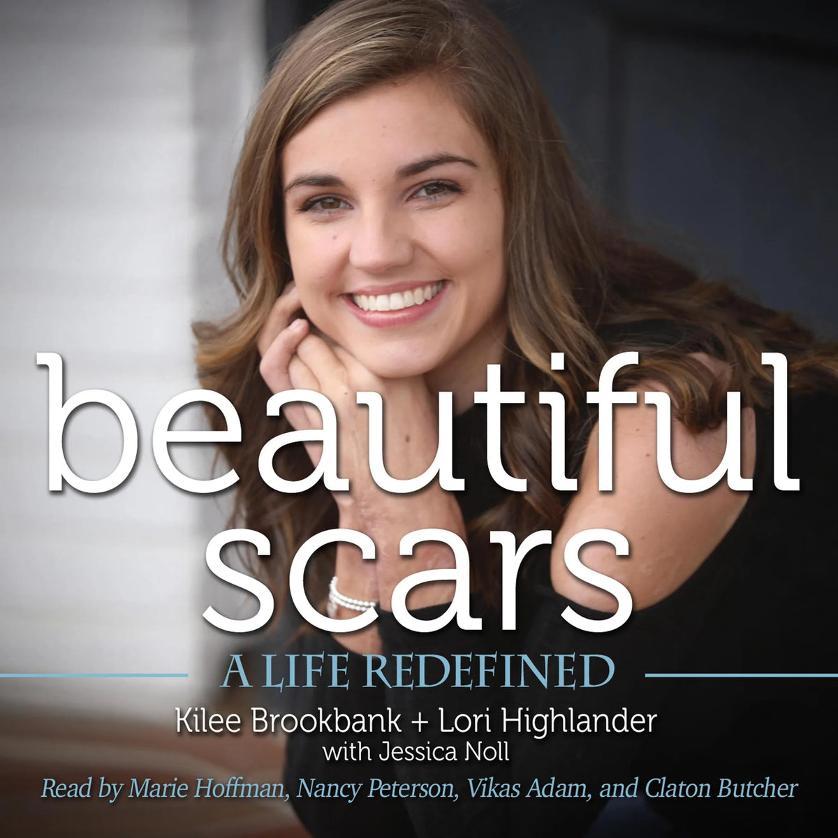 Beautiful Scars
