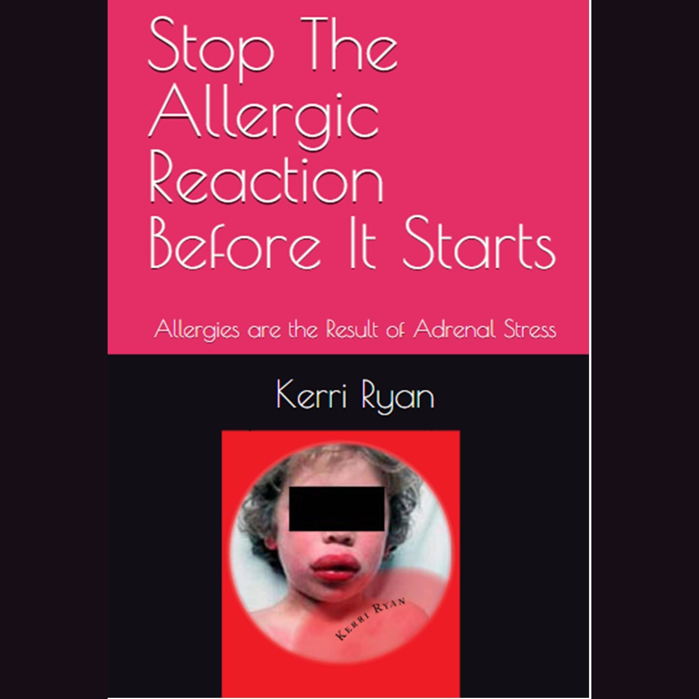 Stop the Allergic Reaction Before It Starts