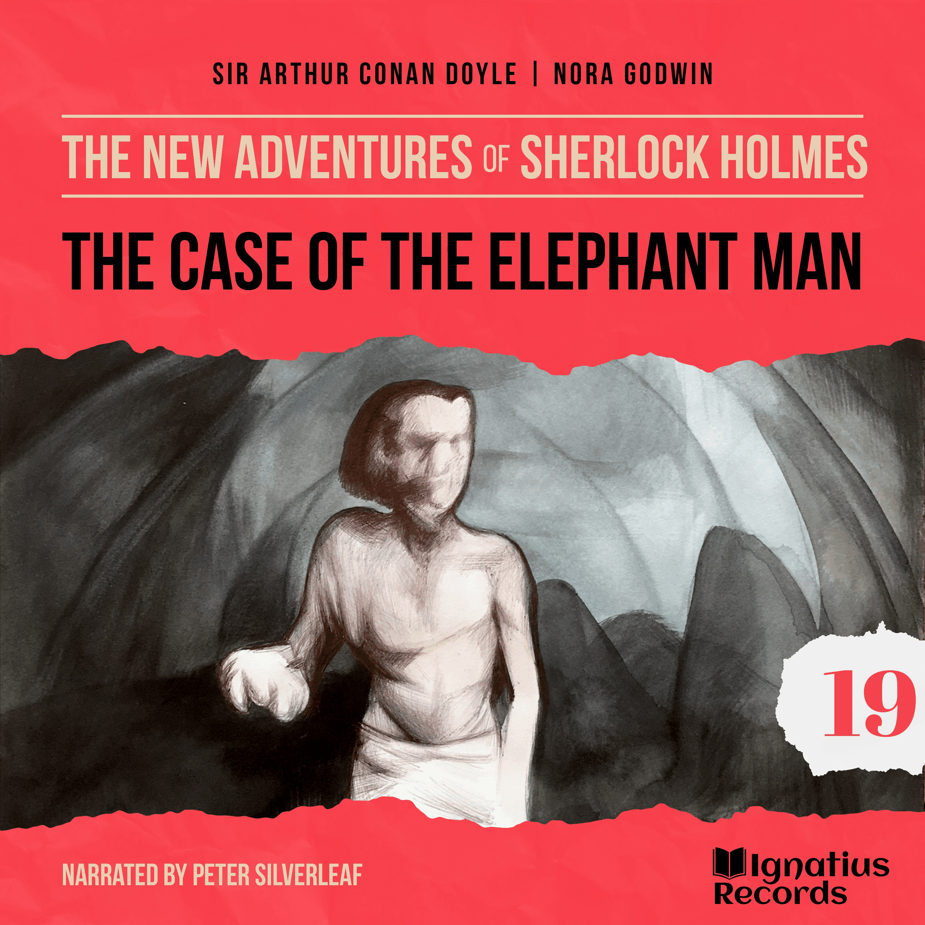 The Case of the Elephant Man (The New Adventures of Sherlock Holmes, Episode 19)