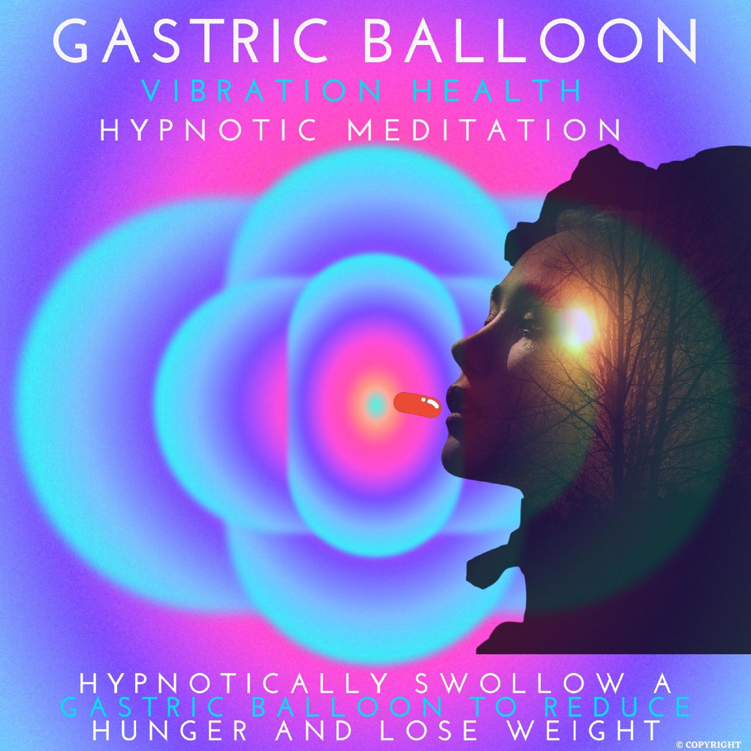 Gastric Balloon