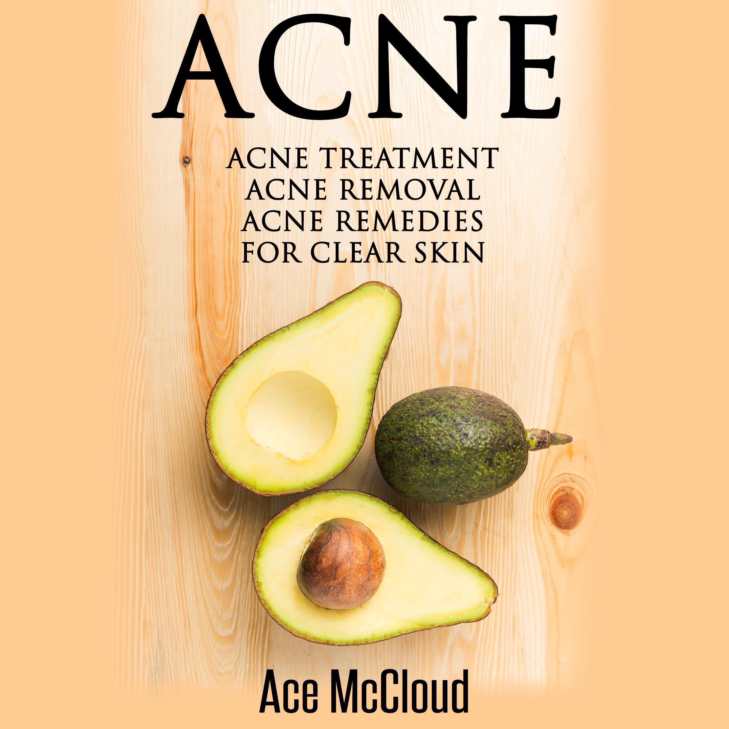 Acne: