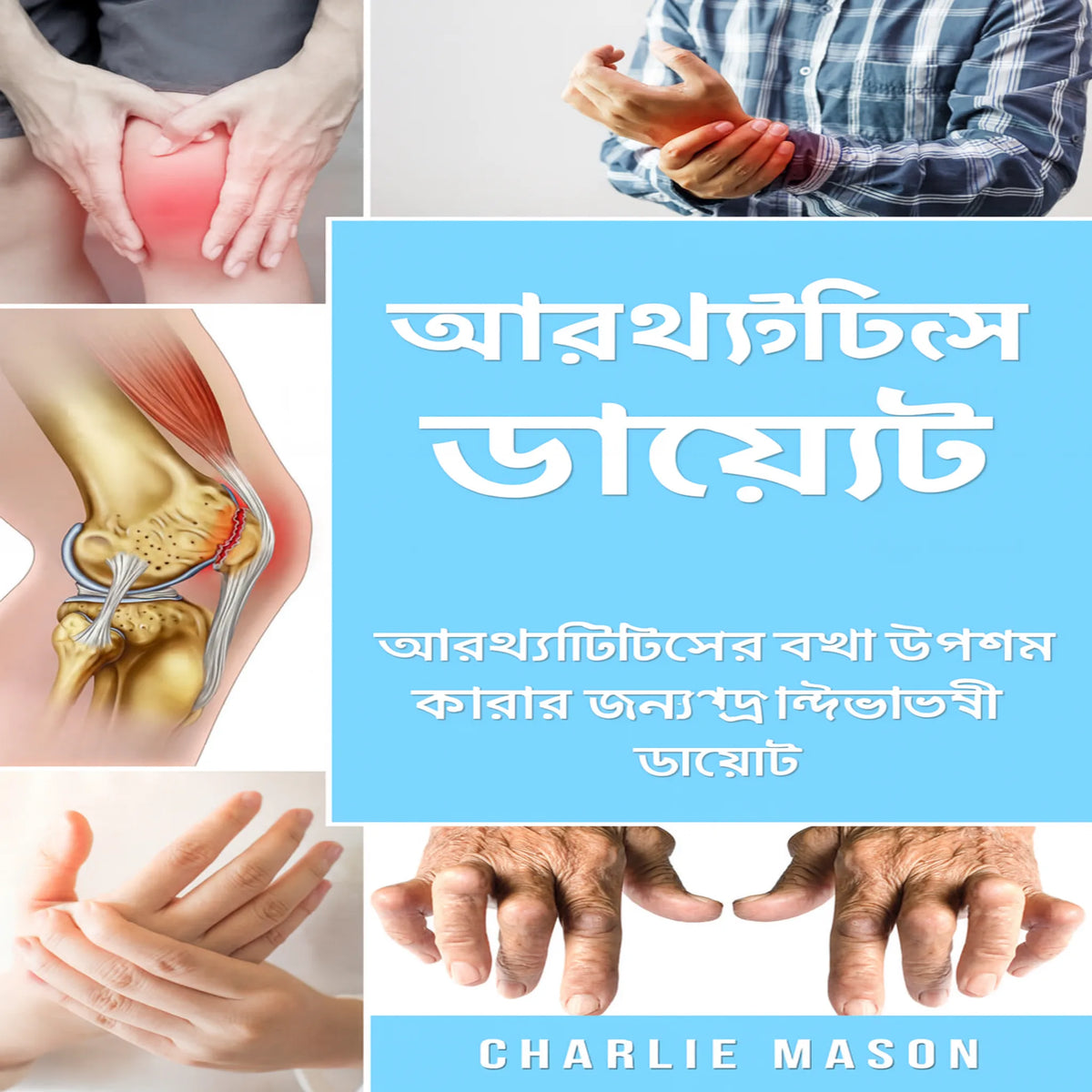 সম্পূর্ণ আর্থ্রাইটিস ডায়েট: আর্থ্রাইটিস ব্যথা উপশমের জন্য প্রদাহ-বিরোধী ডায়েট