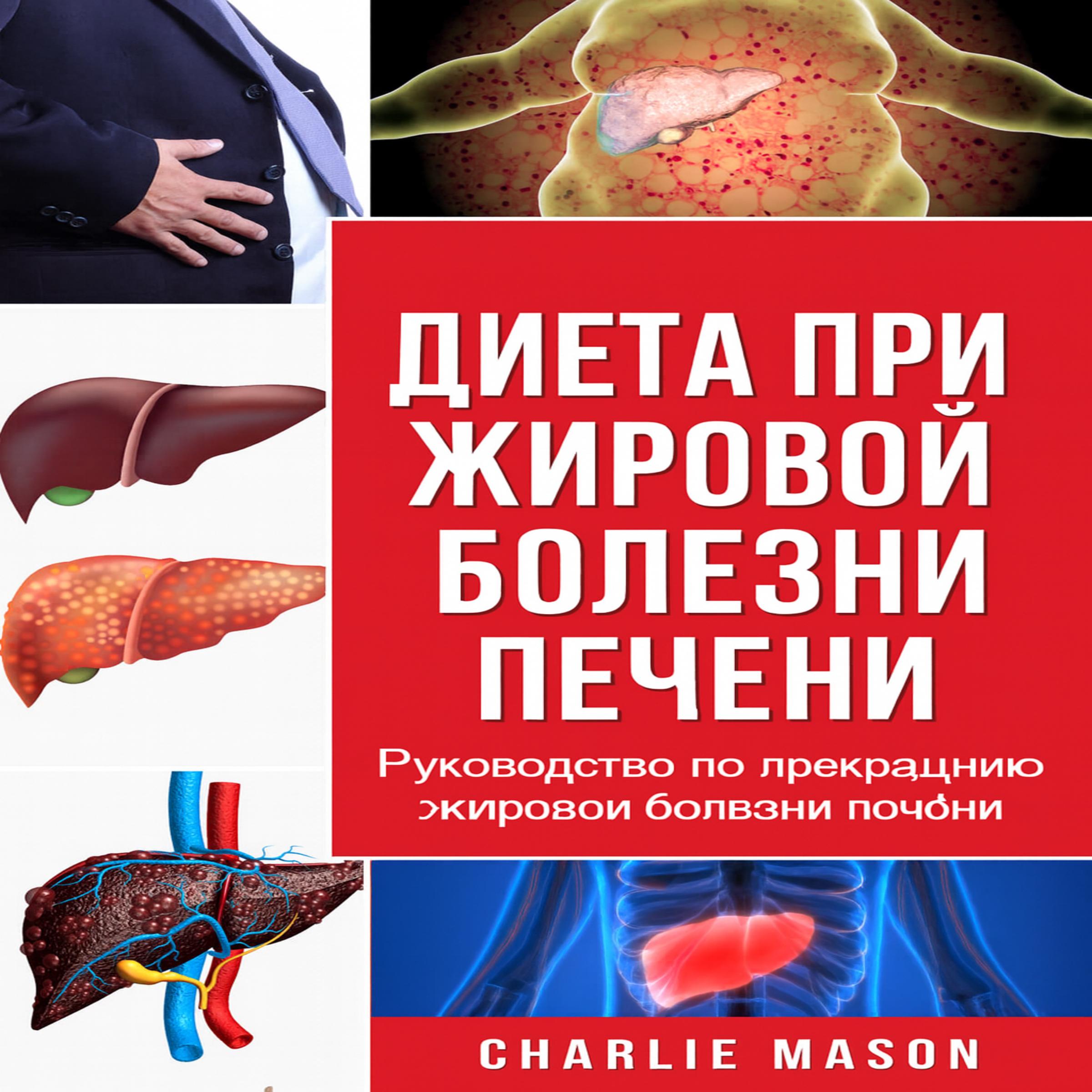 Диета при жировой дистрофии печени. Руководство по лечению заболеваний печени.