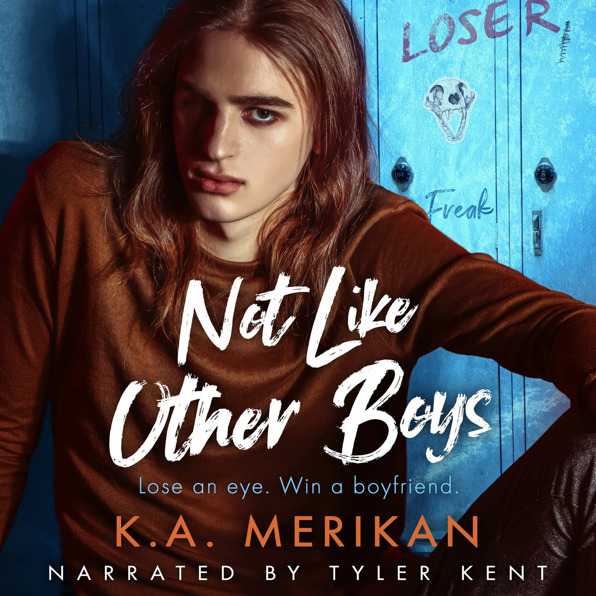 Not Like Other Boys
