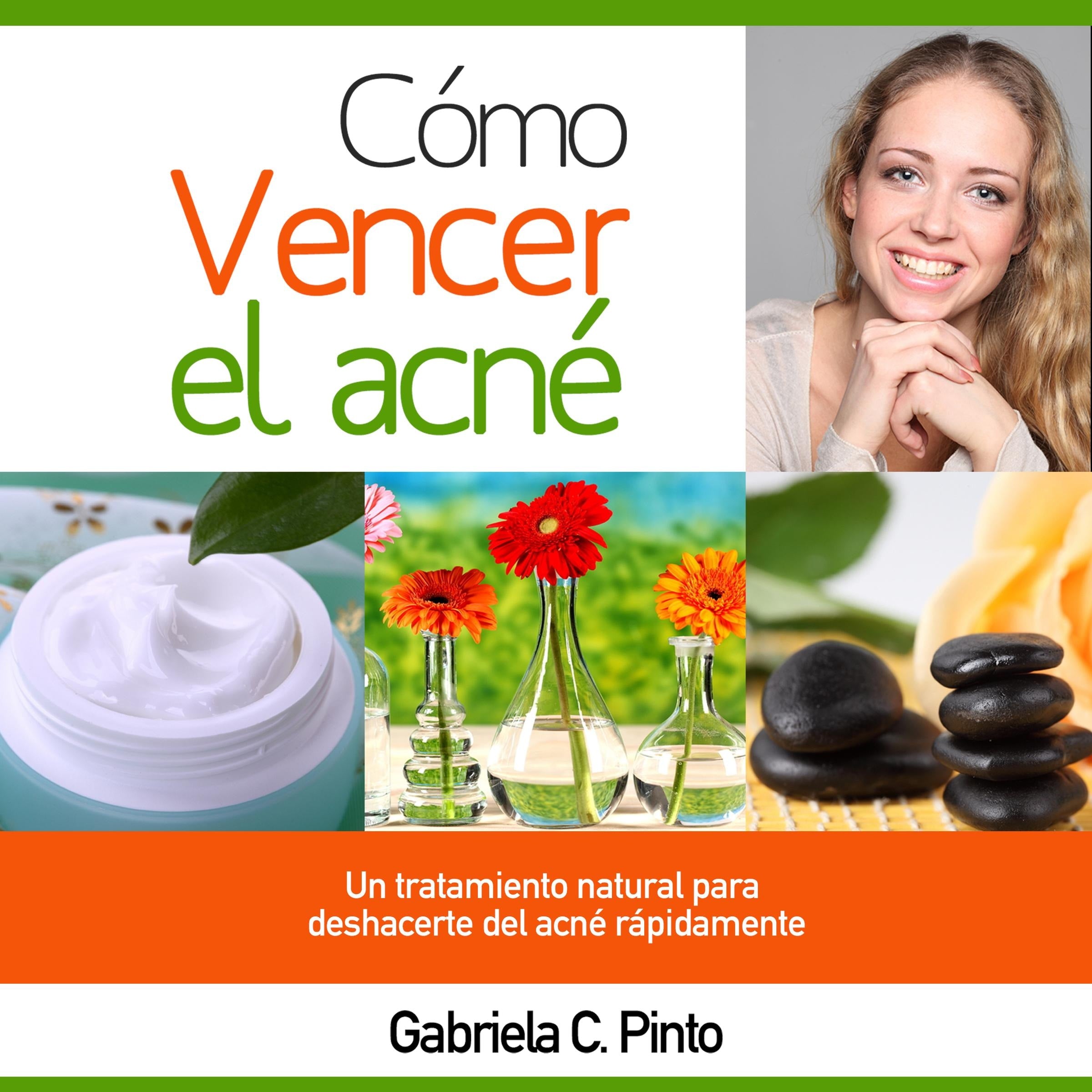 Cómo Vencer el Acné