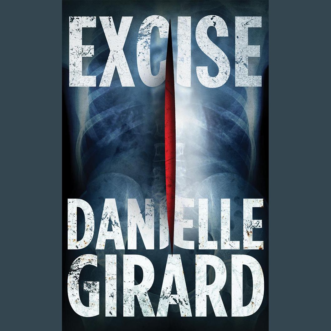 Excise