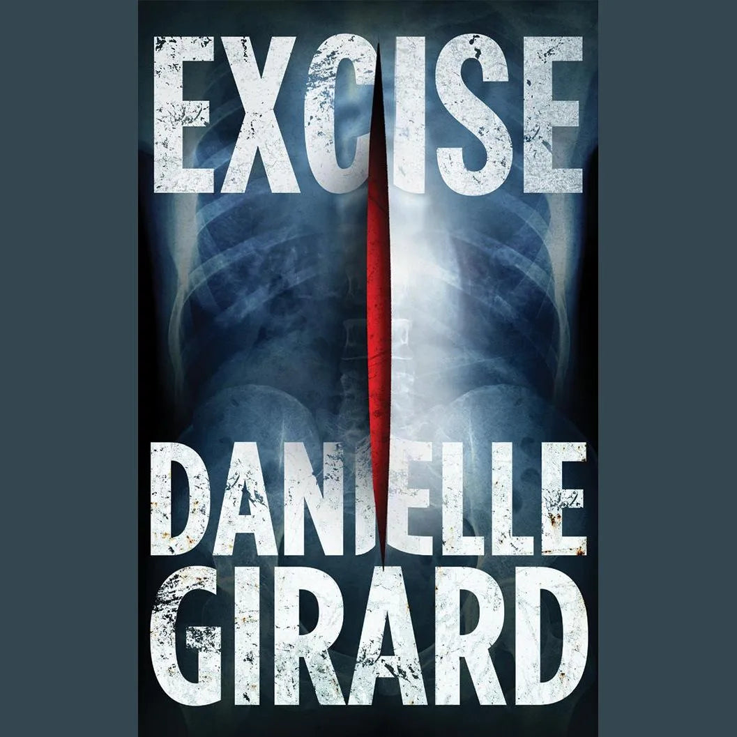 Excise