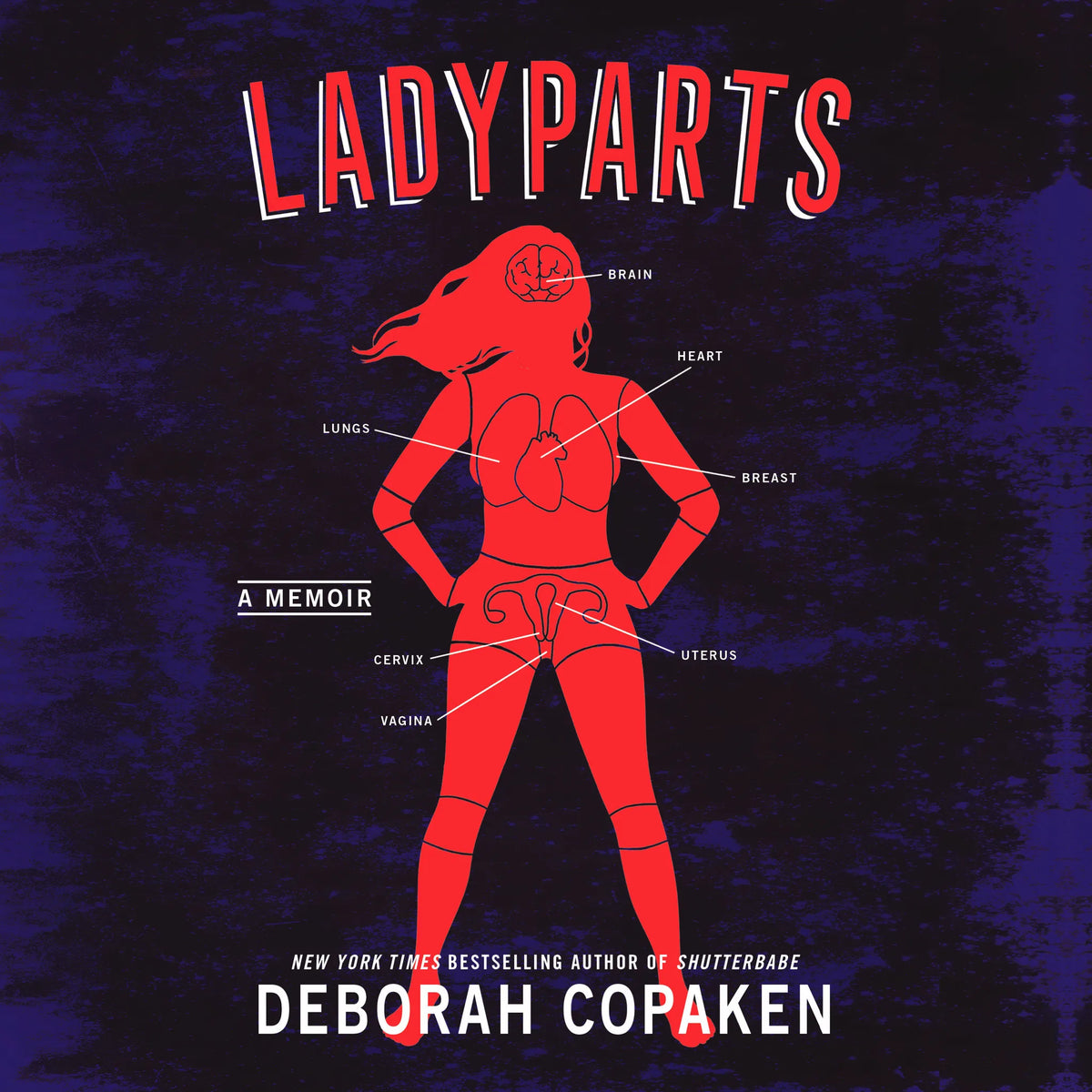 Ladyparts