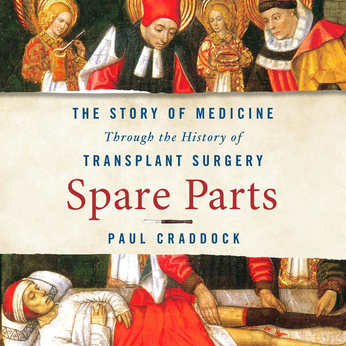 Spare Parts
