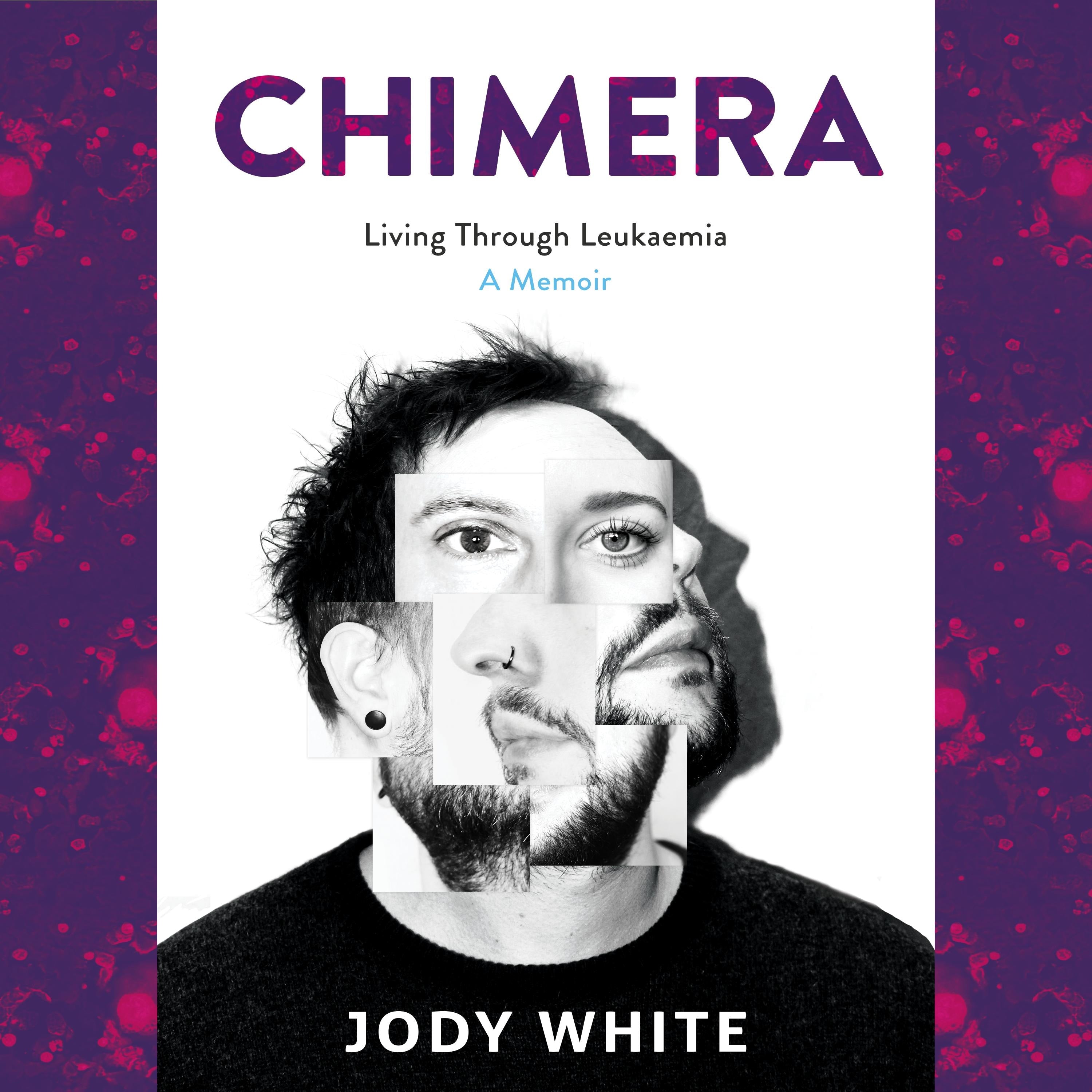 Chimera