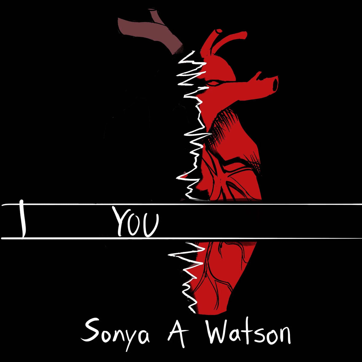 I You