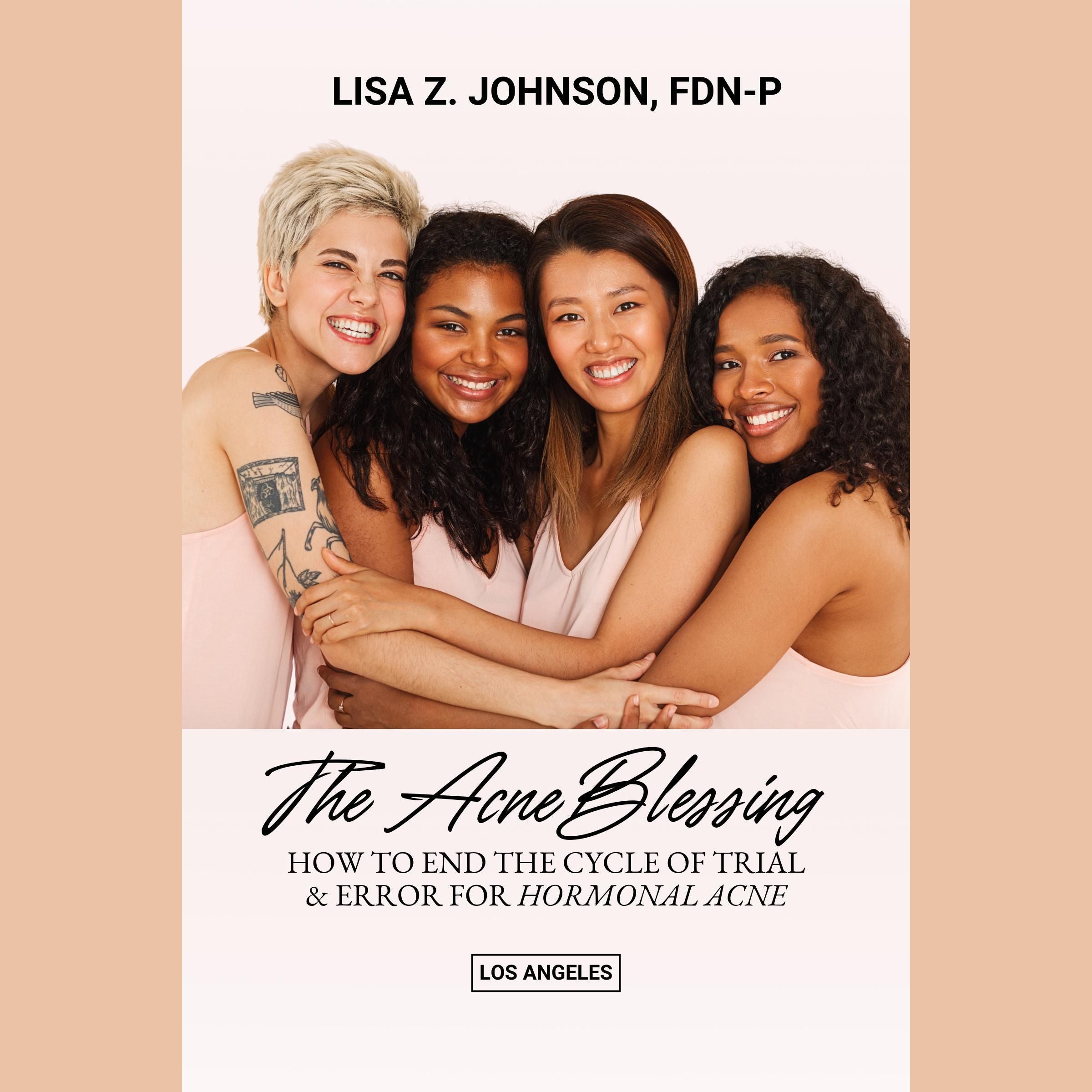 The Acne Blessing