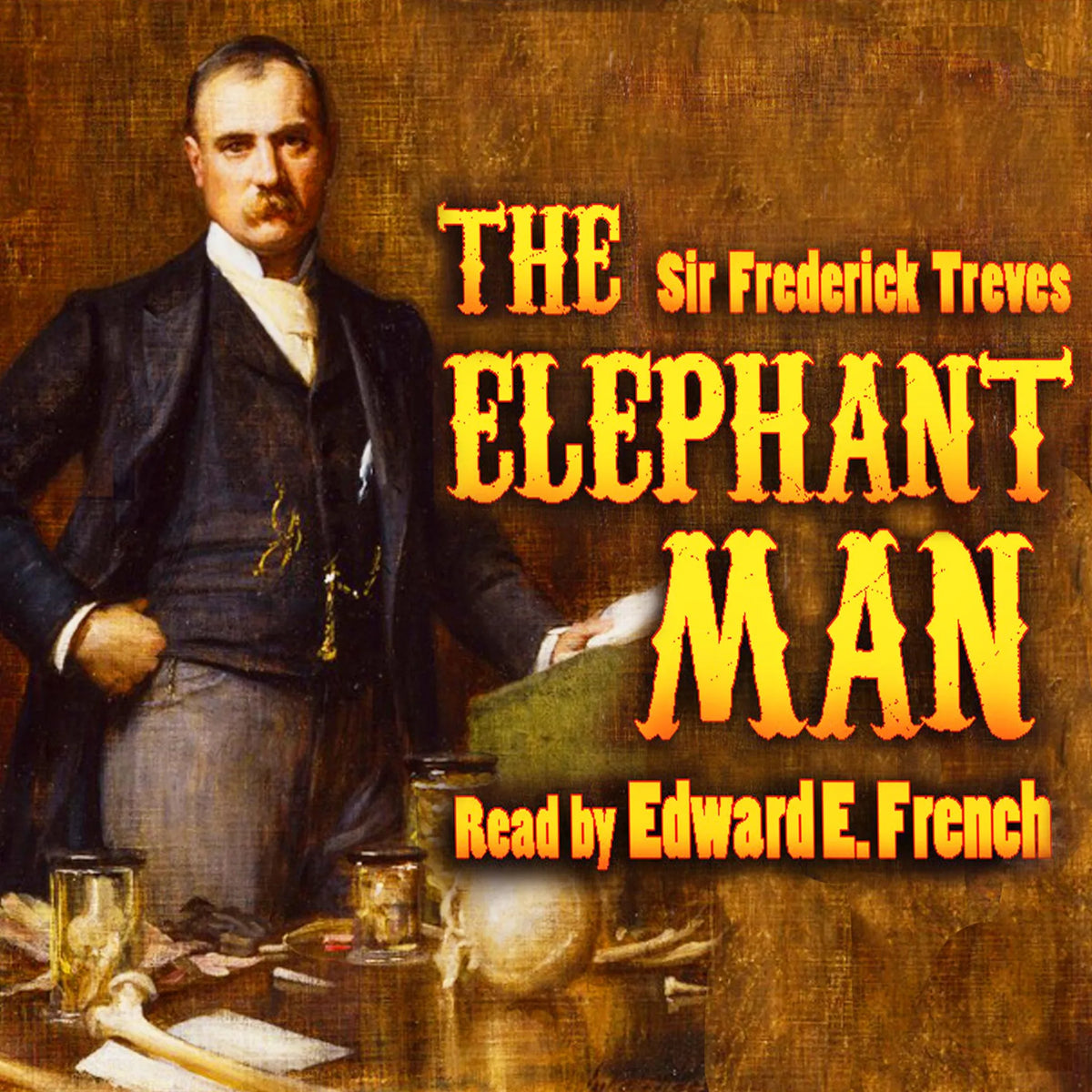 The Elephant Man