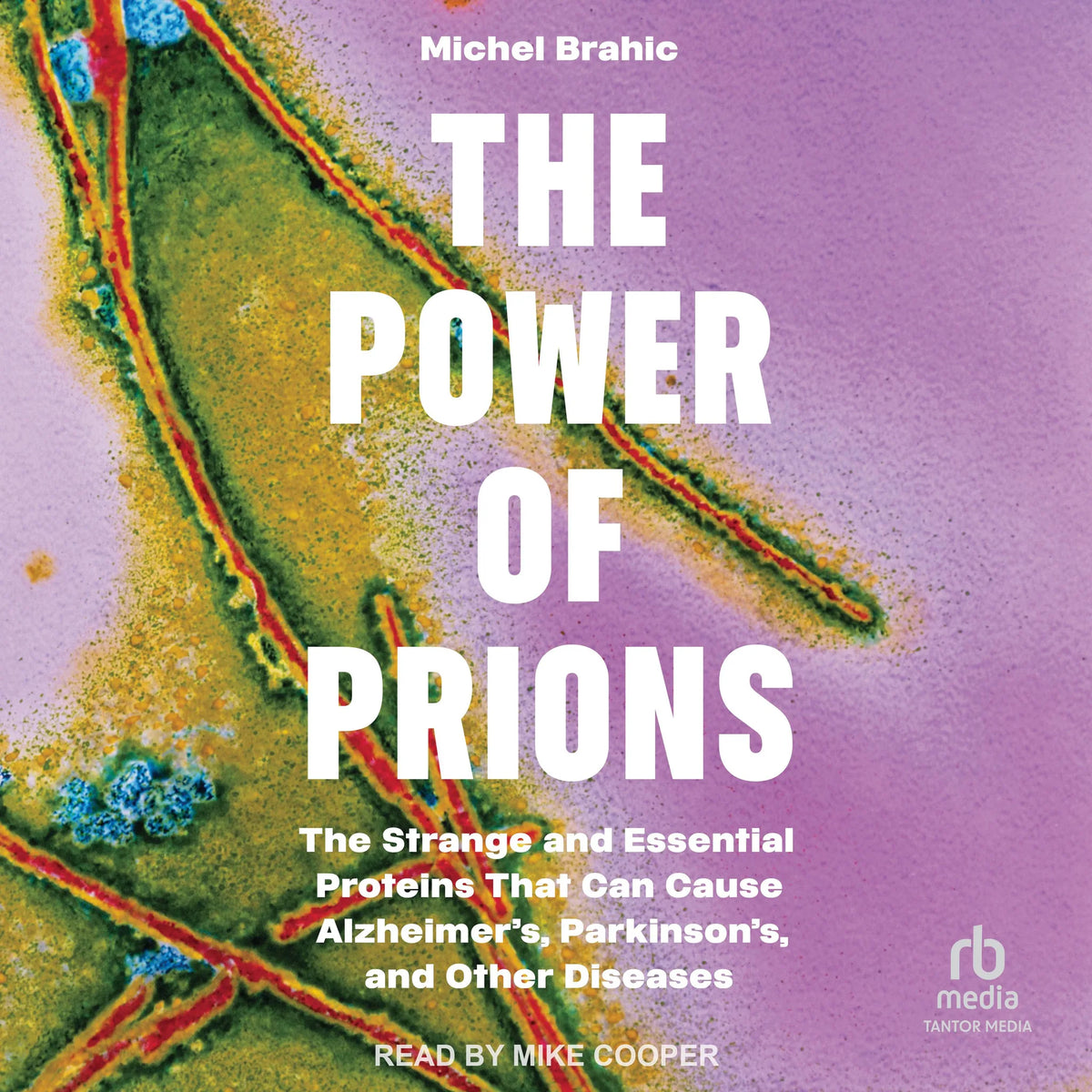 The Power of Prions