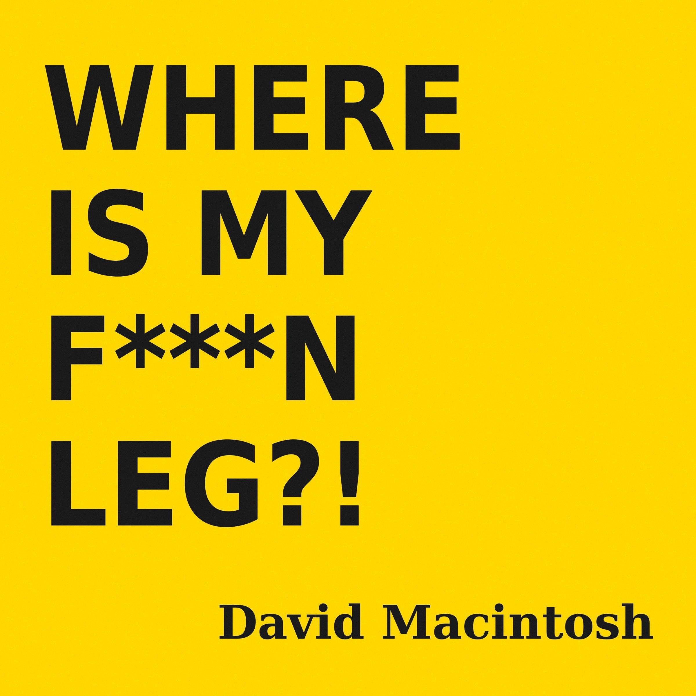 Where is My F***N Leg?!